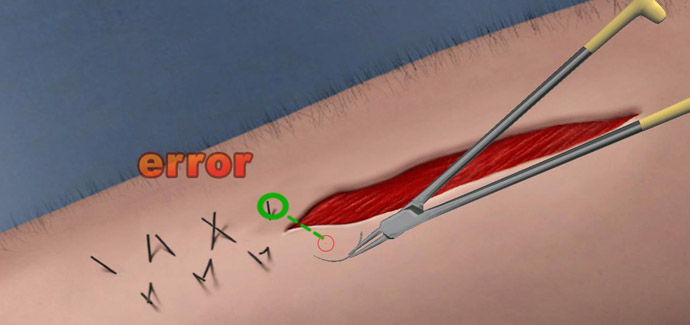 surgsim4